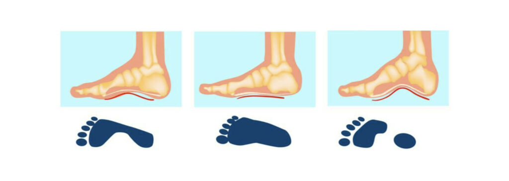 Anatomia do arco dos pés